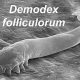 Demodex Mites: Link to Chronic Dry Eye Issues Explained