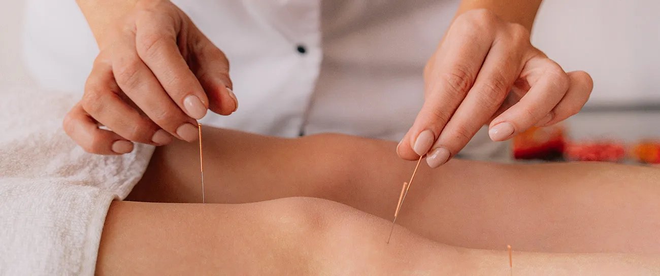A serene acupuncture treatment setup